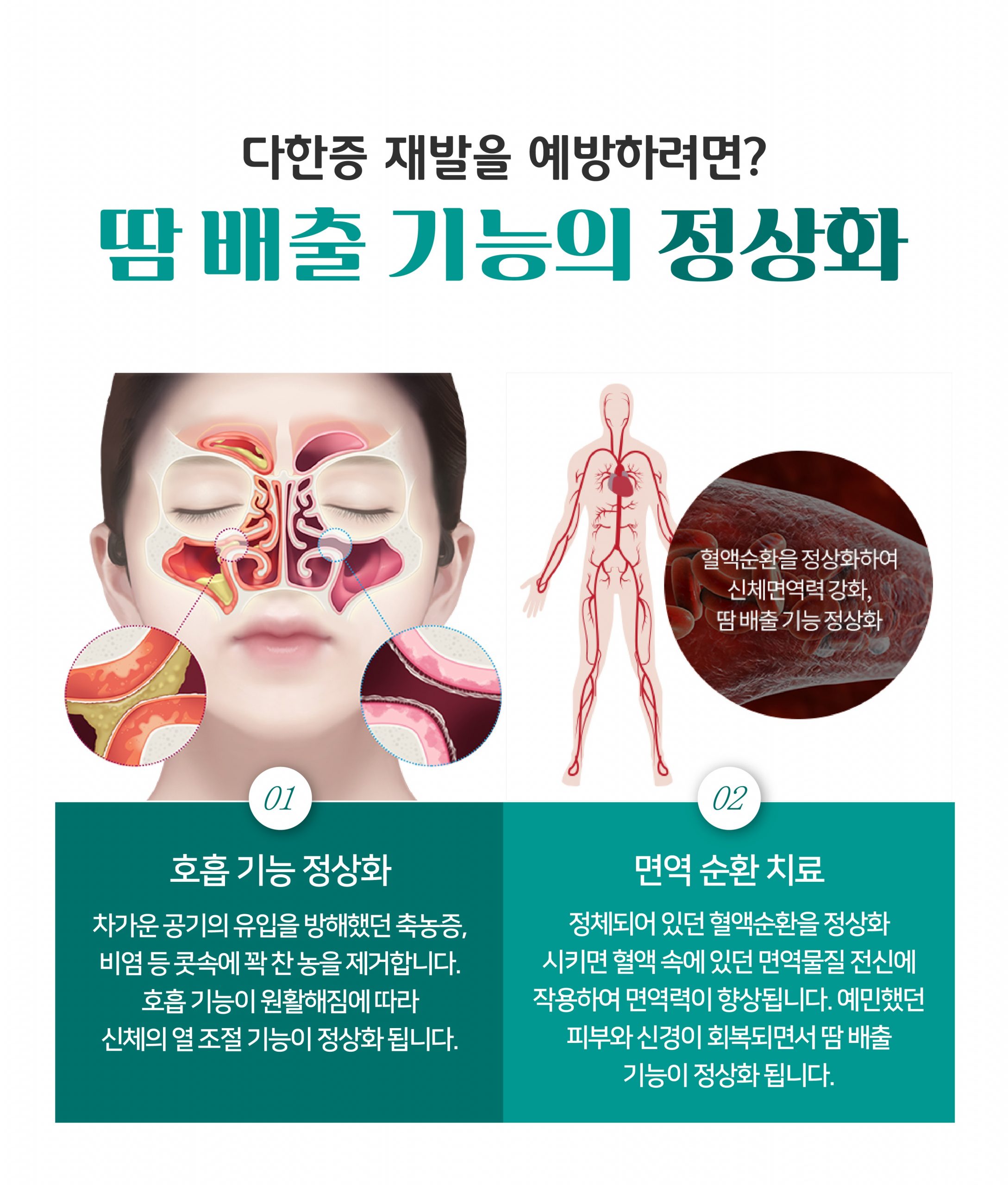 여주 다한증 치료06 scaled