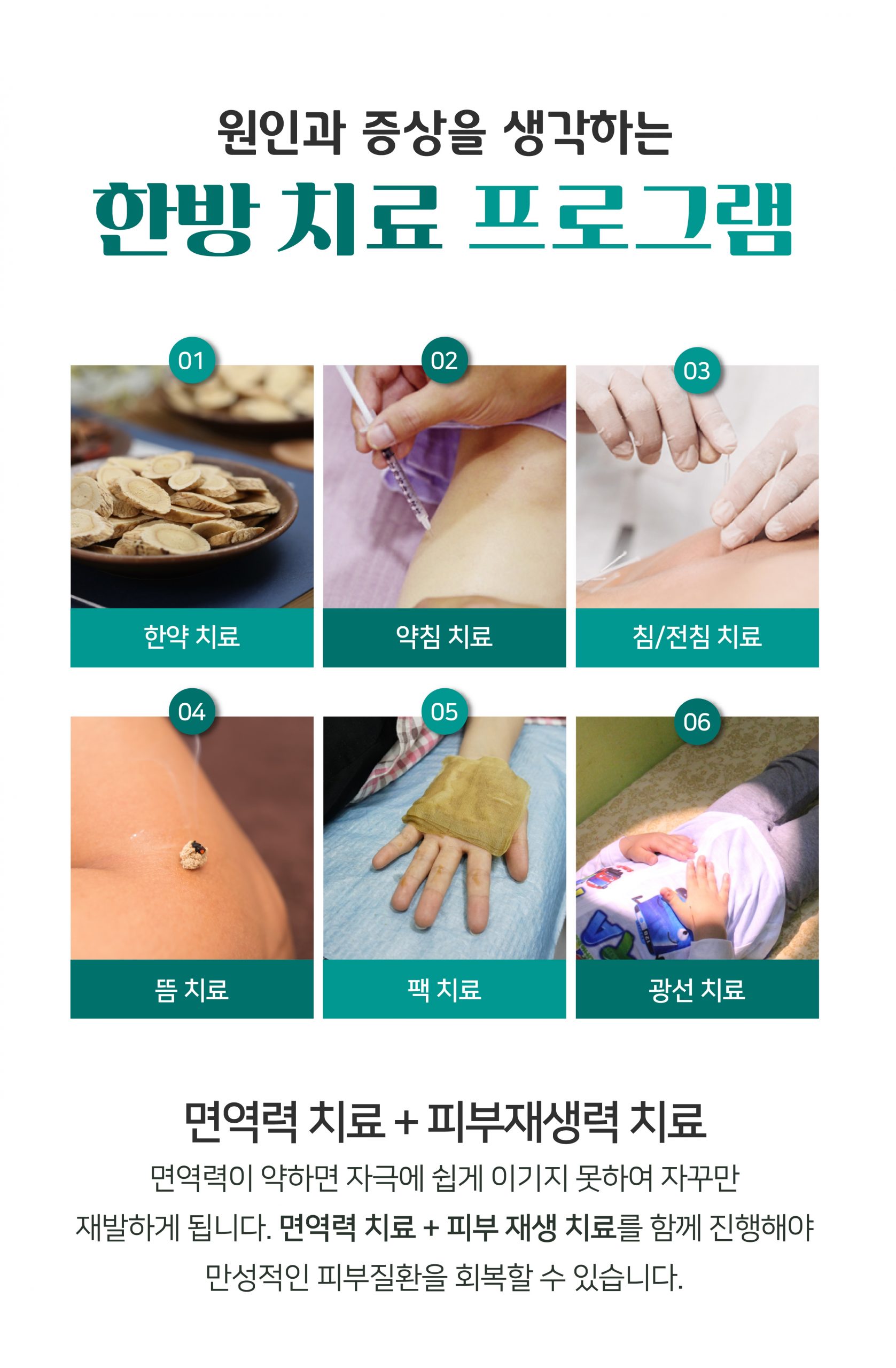 여주 다한증 치료08 scaled