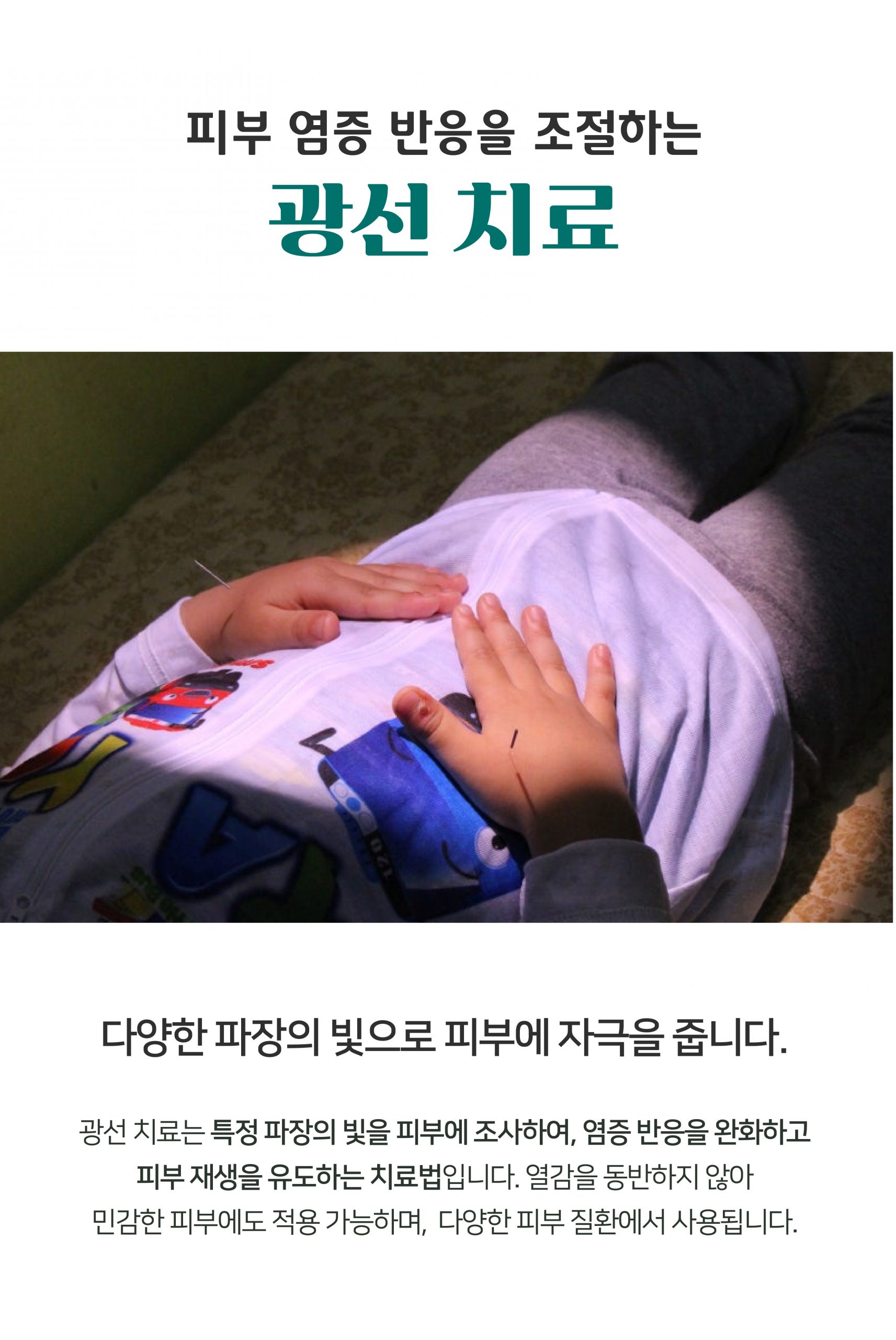 여주 다한증 치료10 scaled