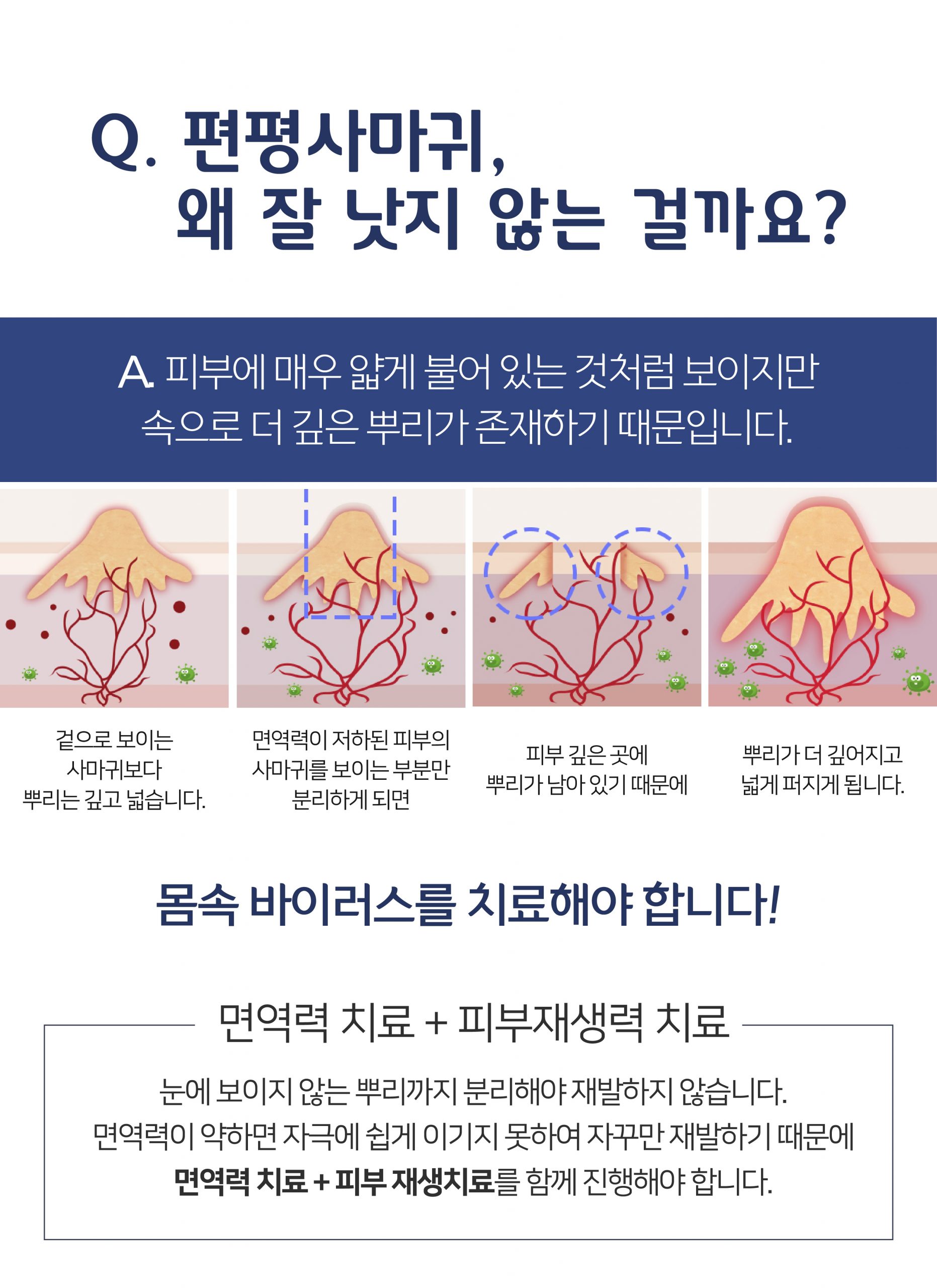 여주 편평사마귀 제거004 scaled