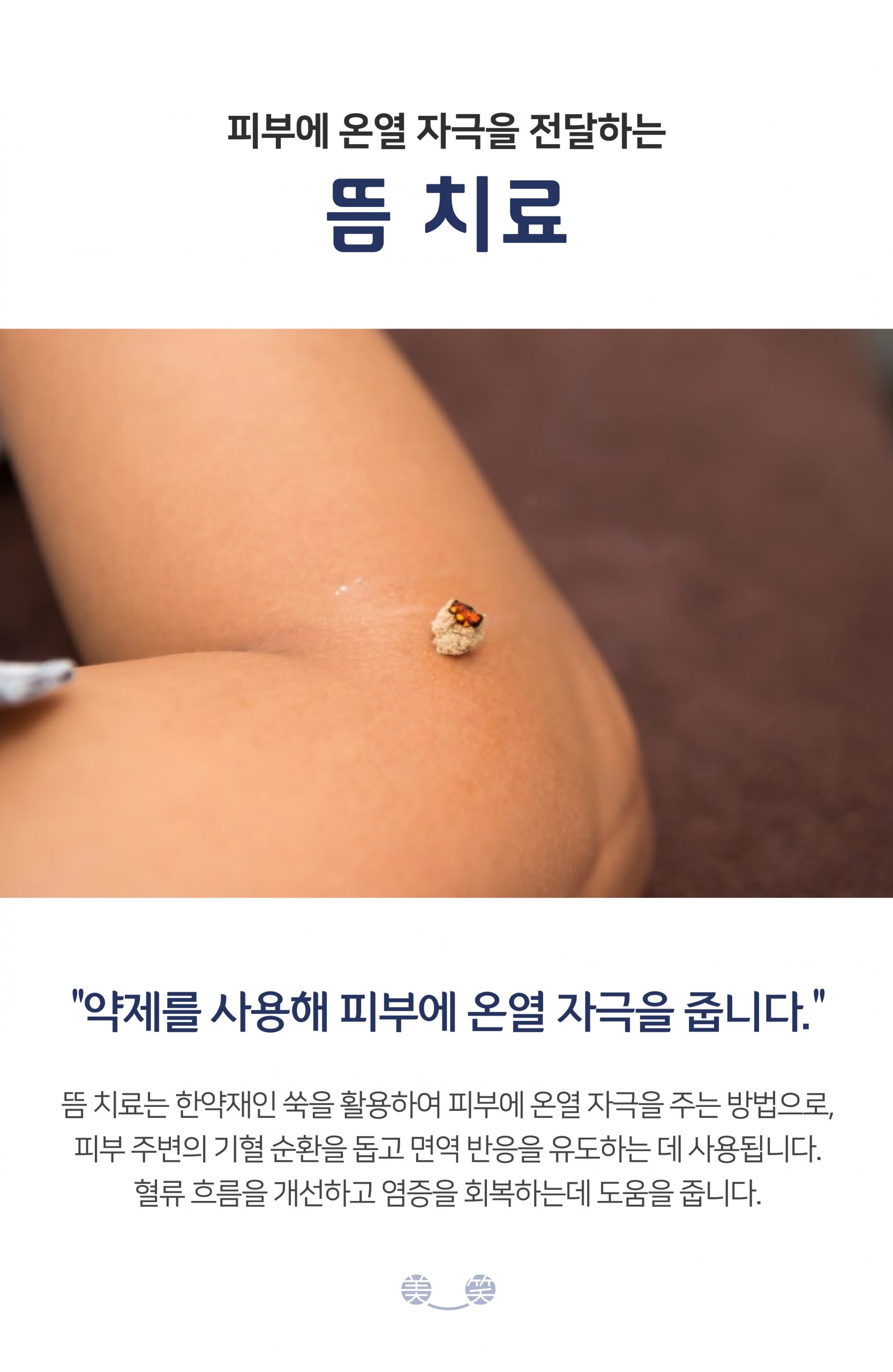 여주 편평사마귀 제거009 scaled