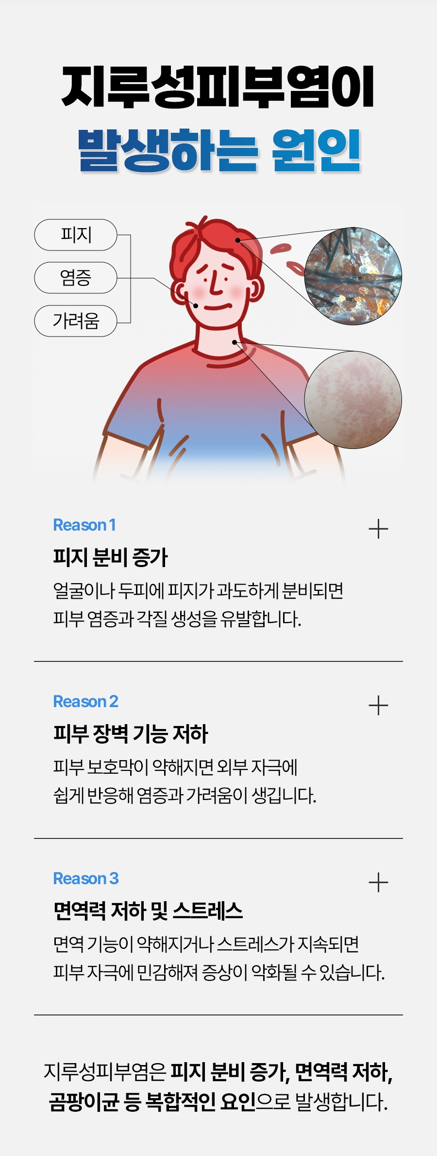 여주지루성피부염병원003