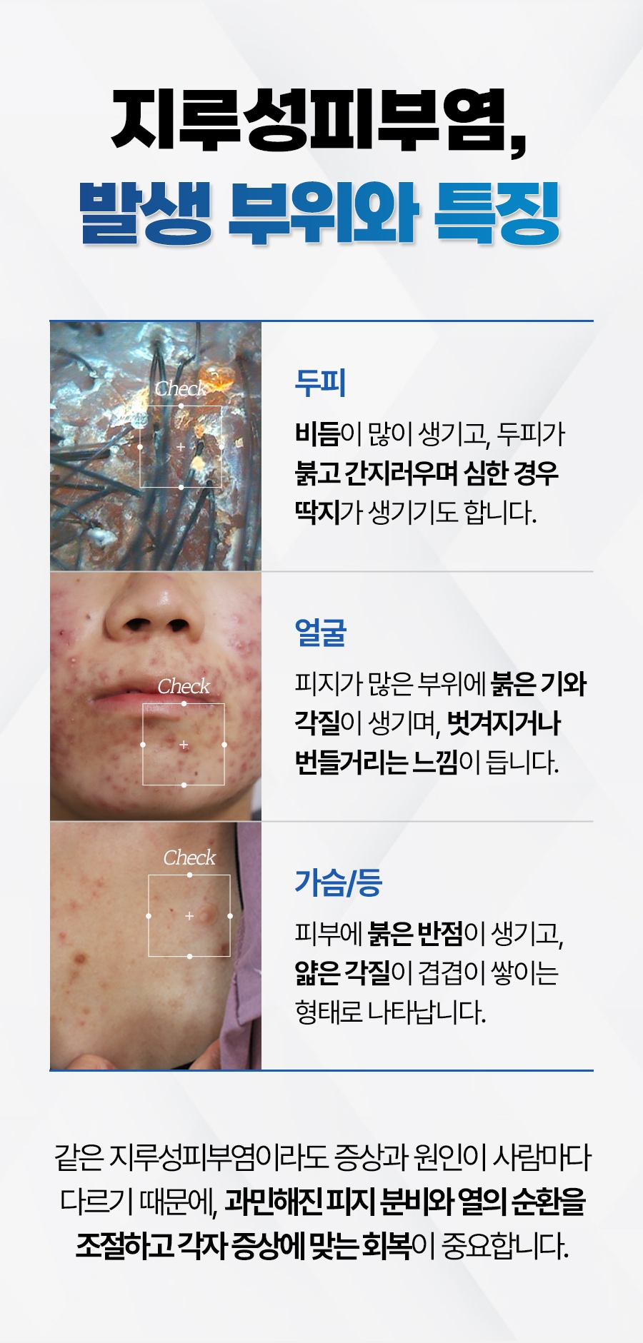 여주지루성피부염병원006