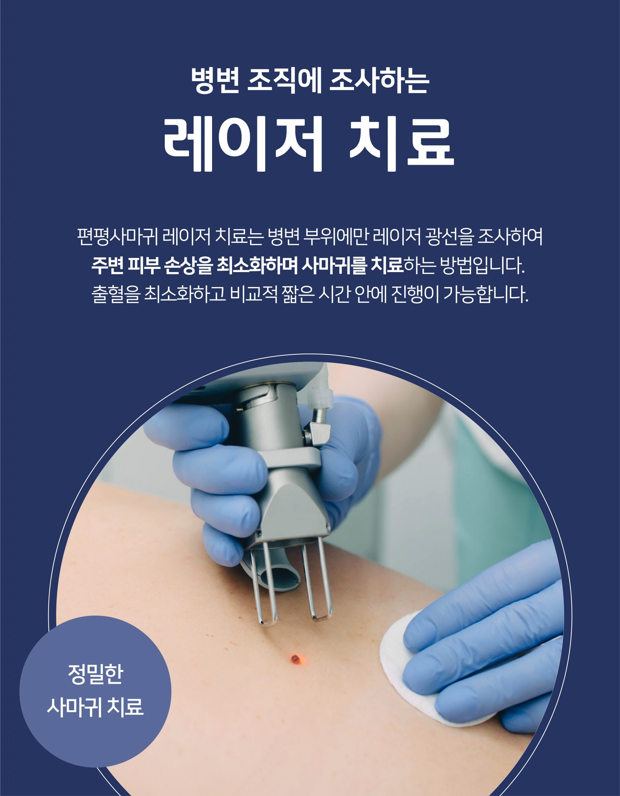 여주편평사마귀병원011 scaled