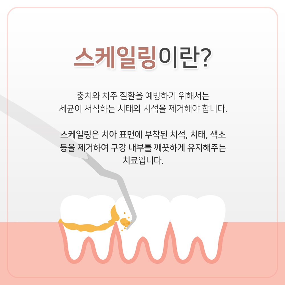 역북동추천14