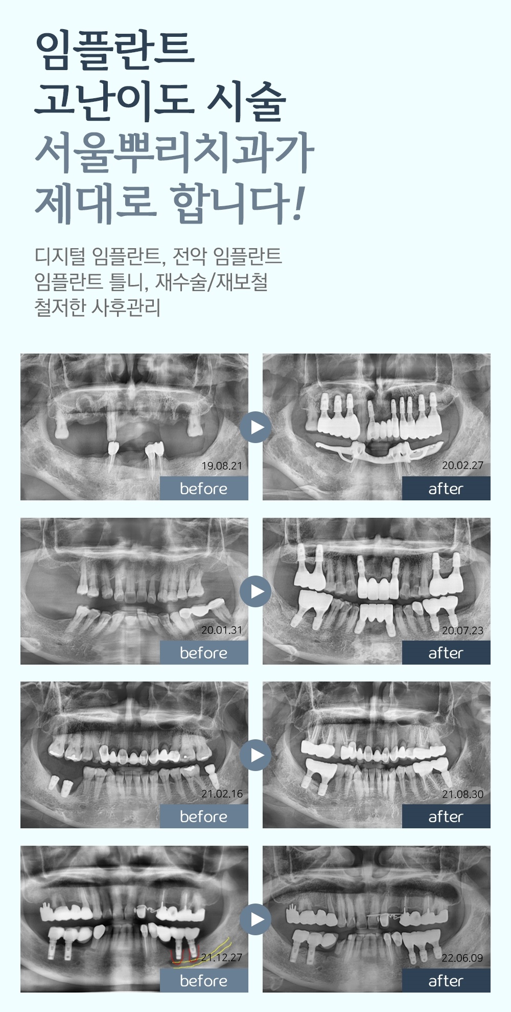 역북동추천6