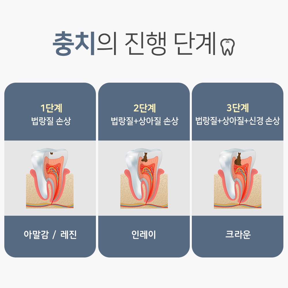 오산충치치료8