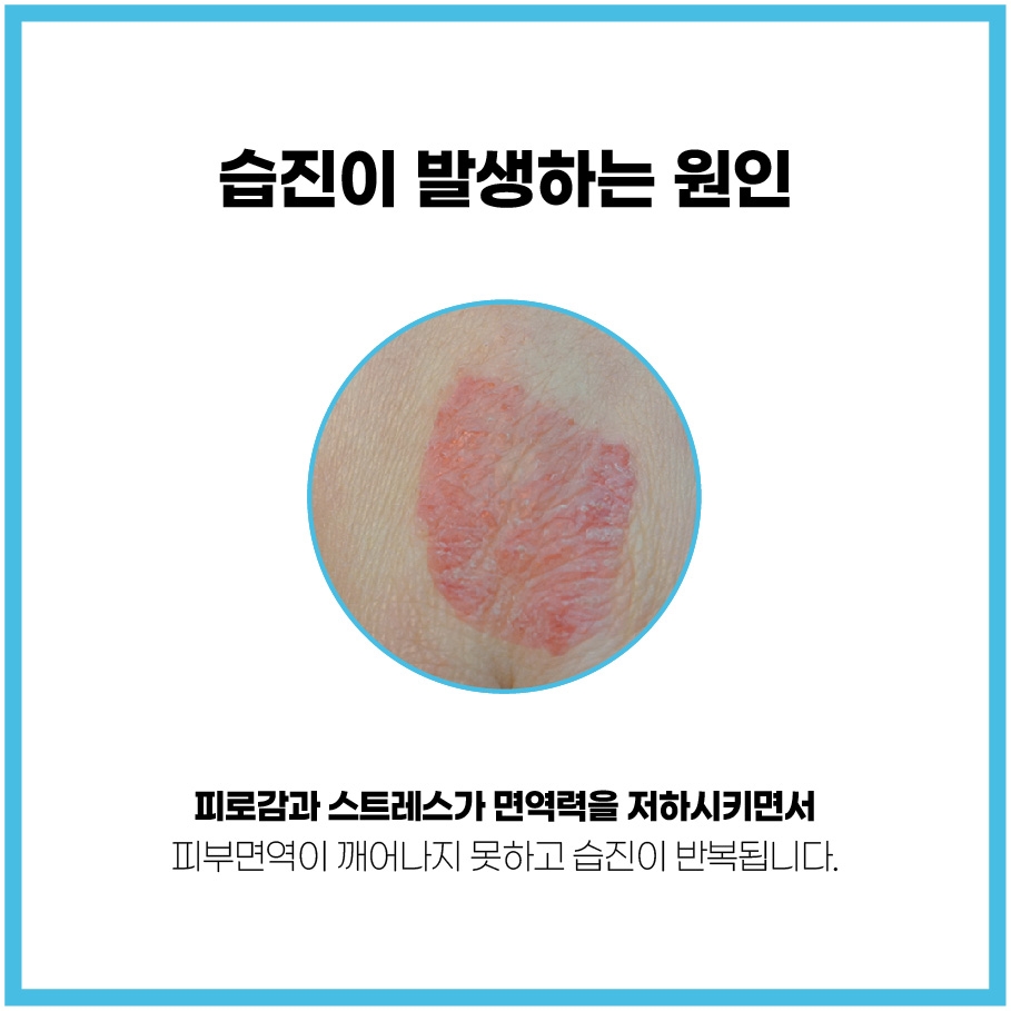완주 피부과질환 병원003