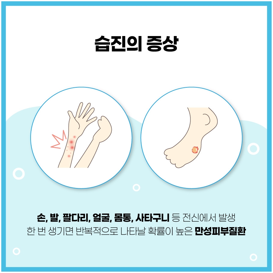 완주 피부과질환 병원004