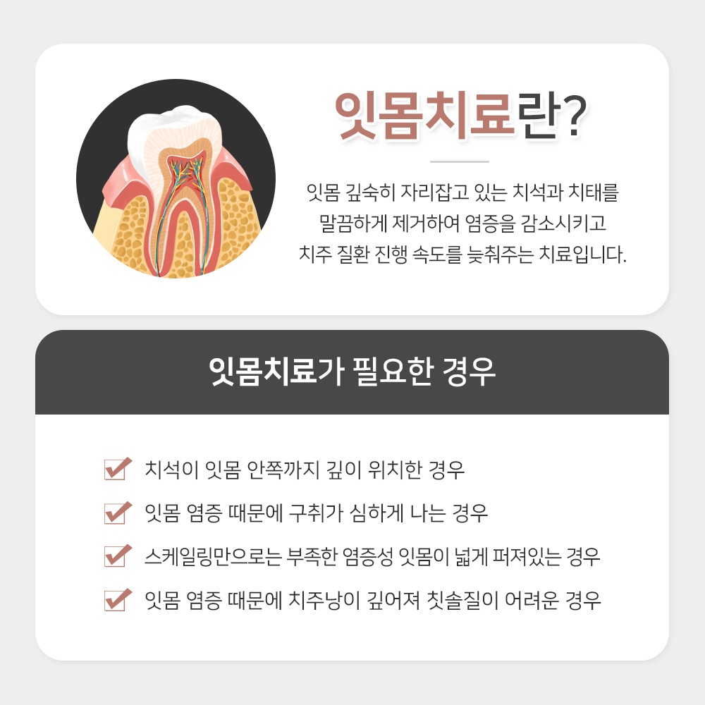 용인처인구15