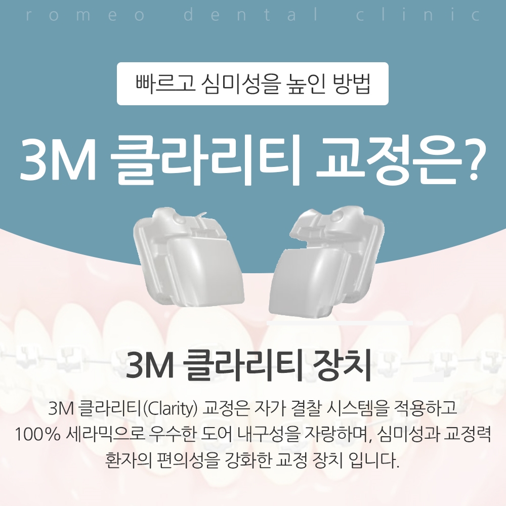 용인치아교정 추천 잘하는곳23