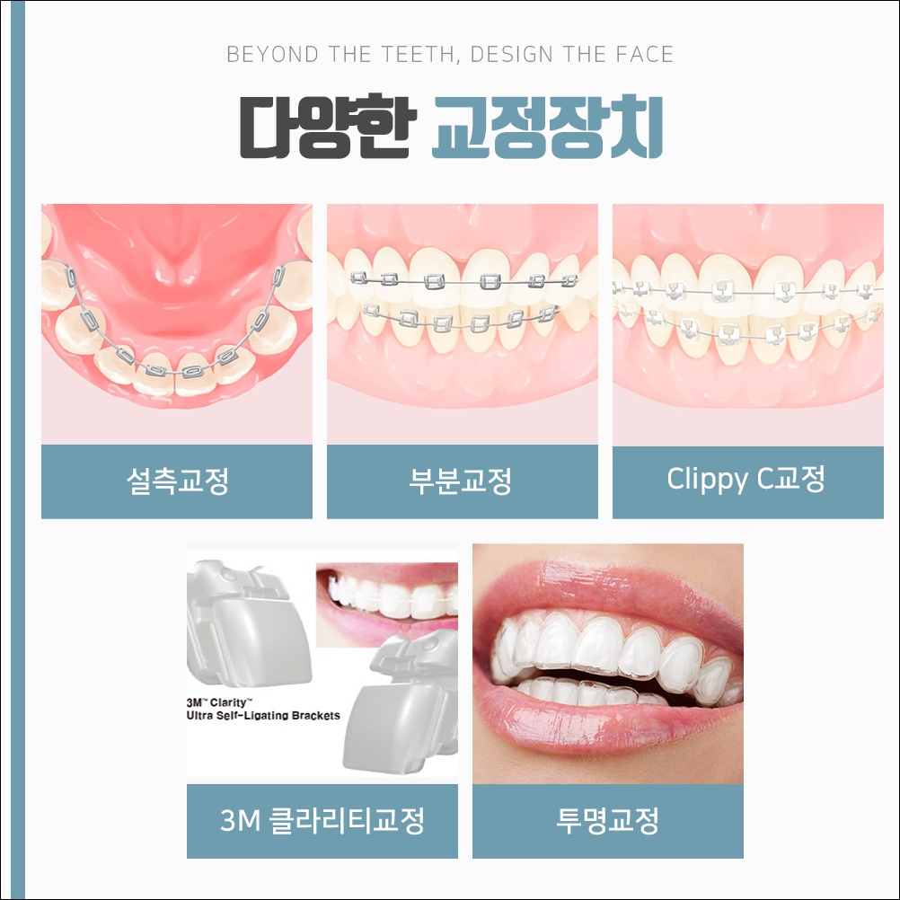 용인치아교정추천10