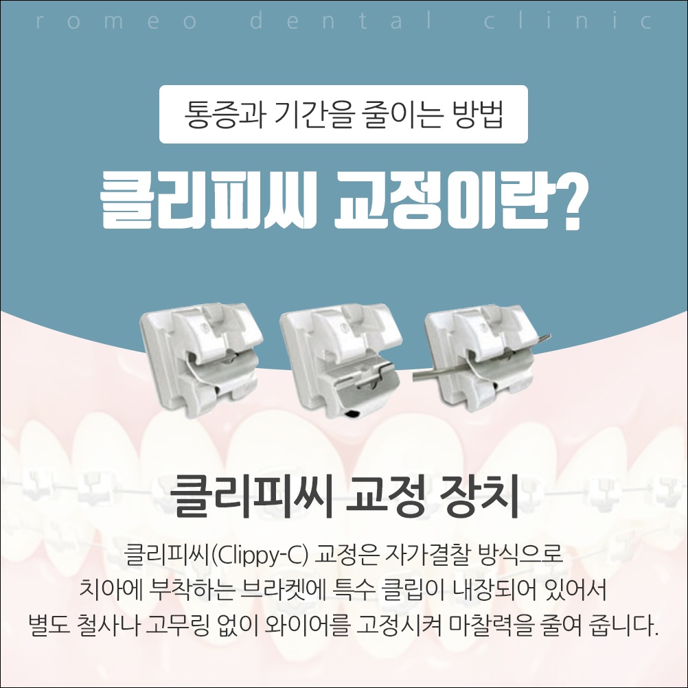 용인치아교정추천12
