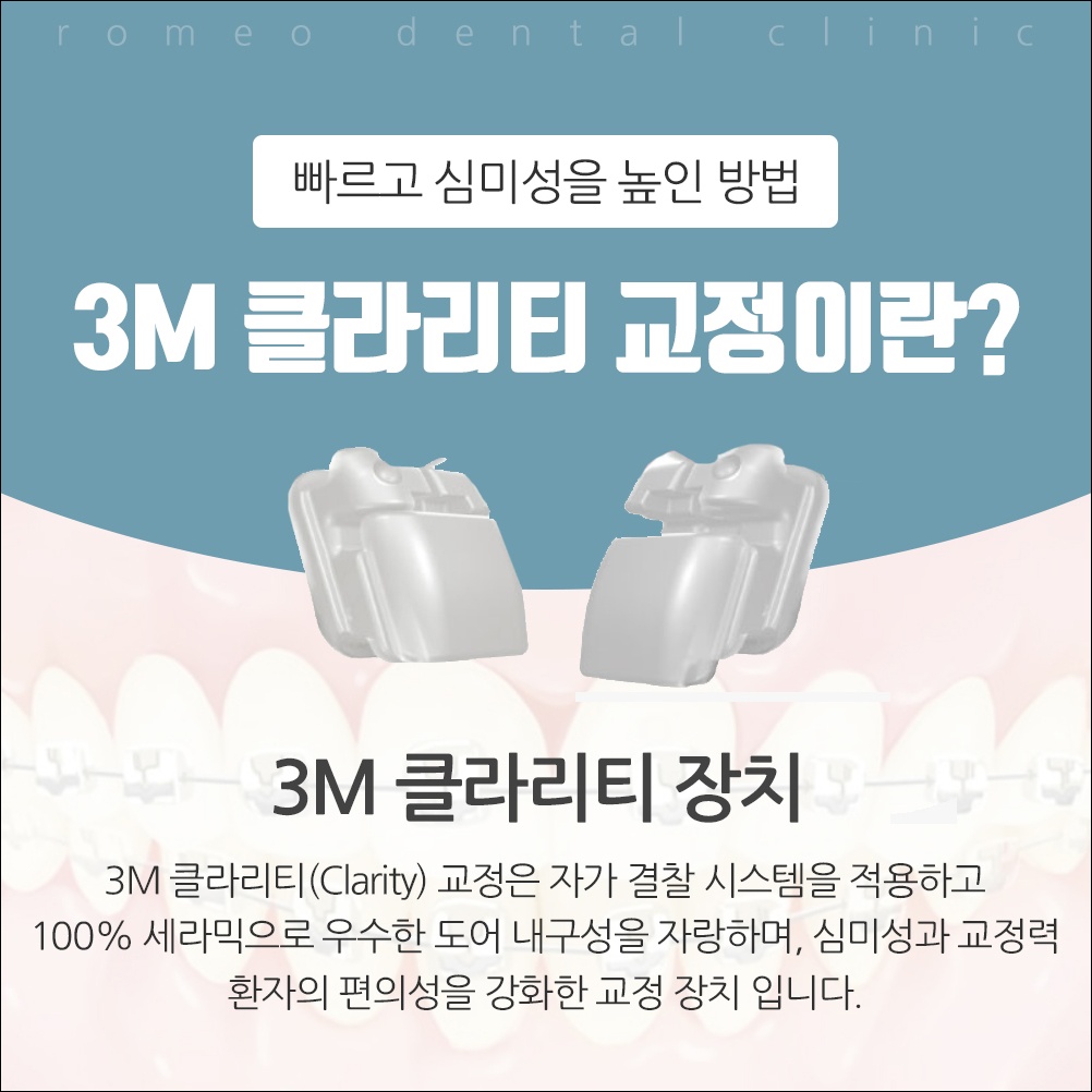 용인치아교정추천14