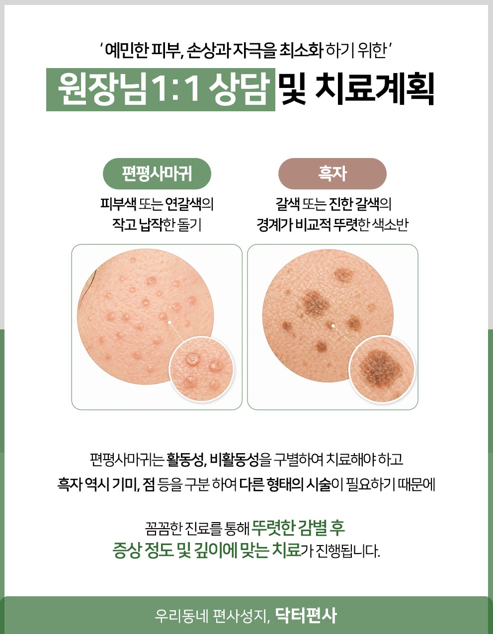 용인편평사마귀성지018