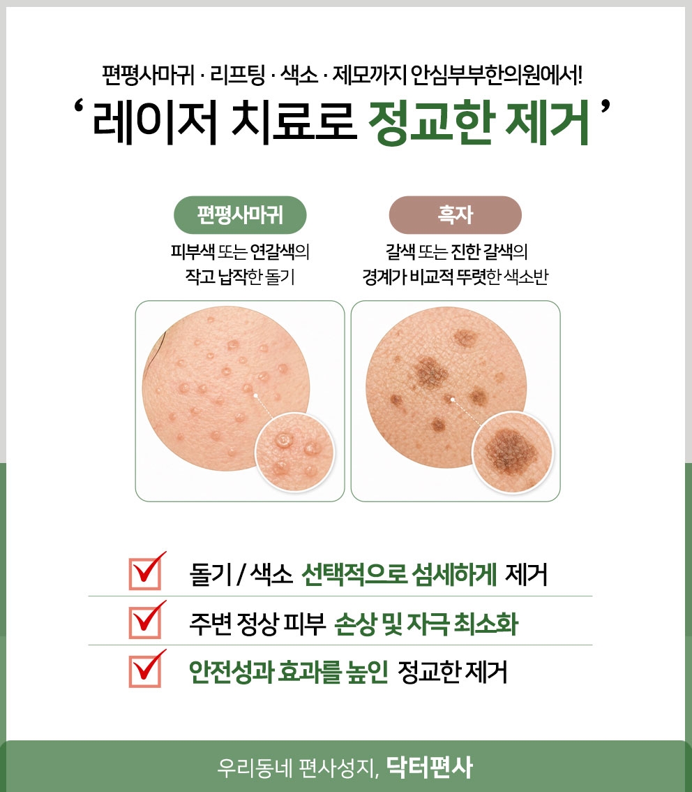 이대편평사마귀성지013