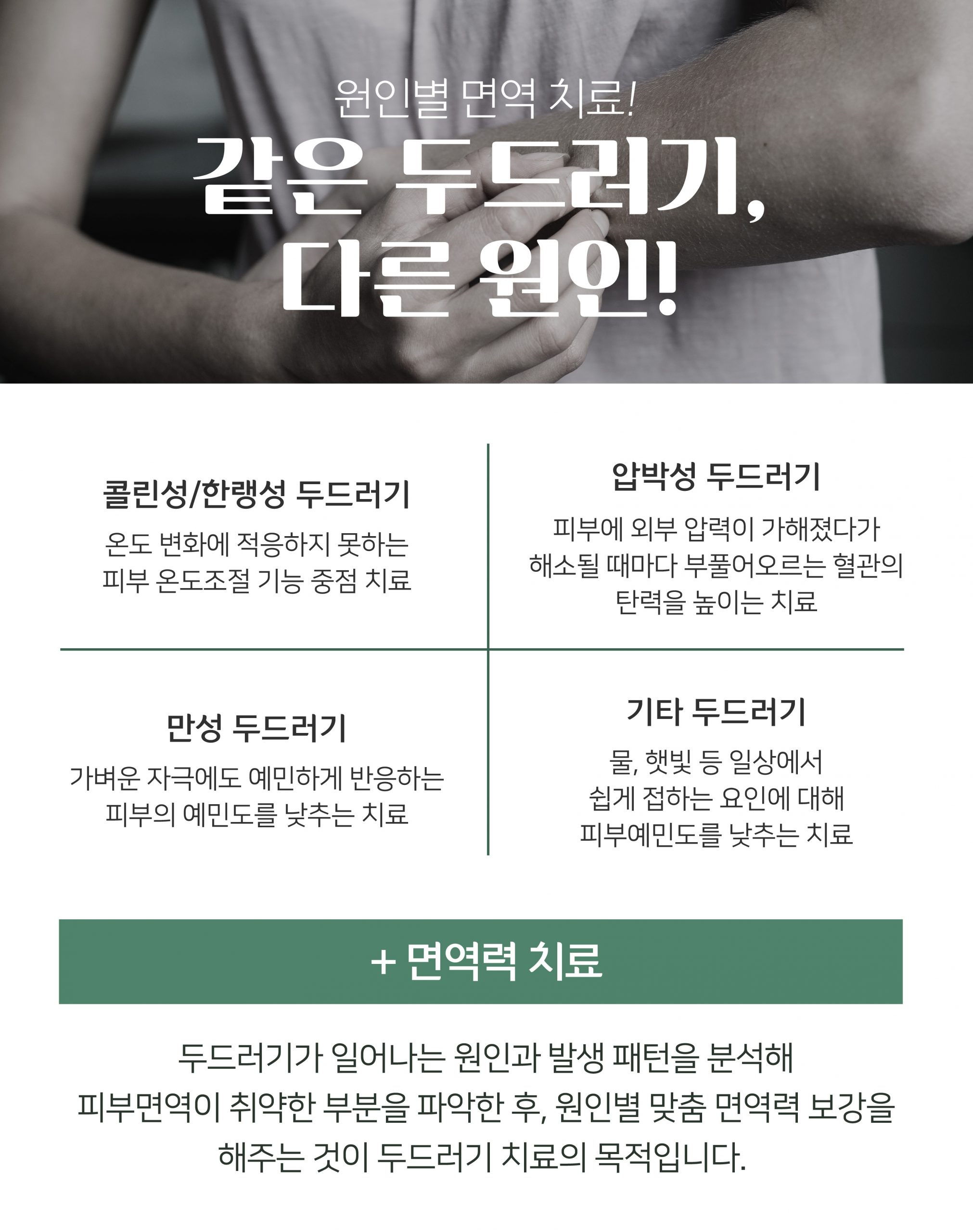이천 두드러기 치료004 scaled