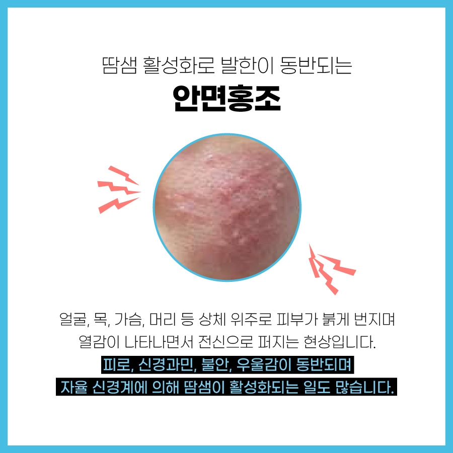 이천 안면홍조 치료003 1