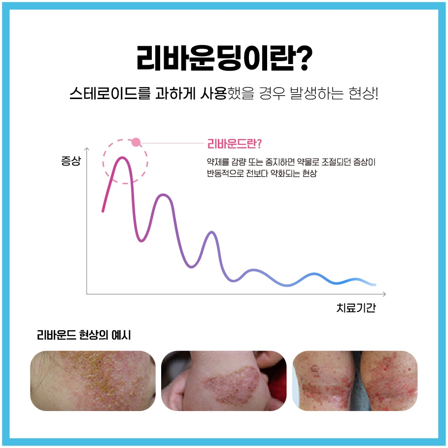 이천 안면홍조 치료006 1