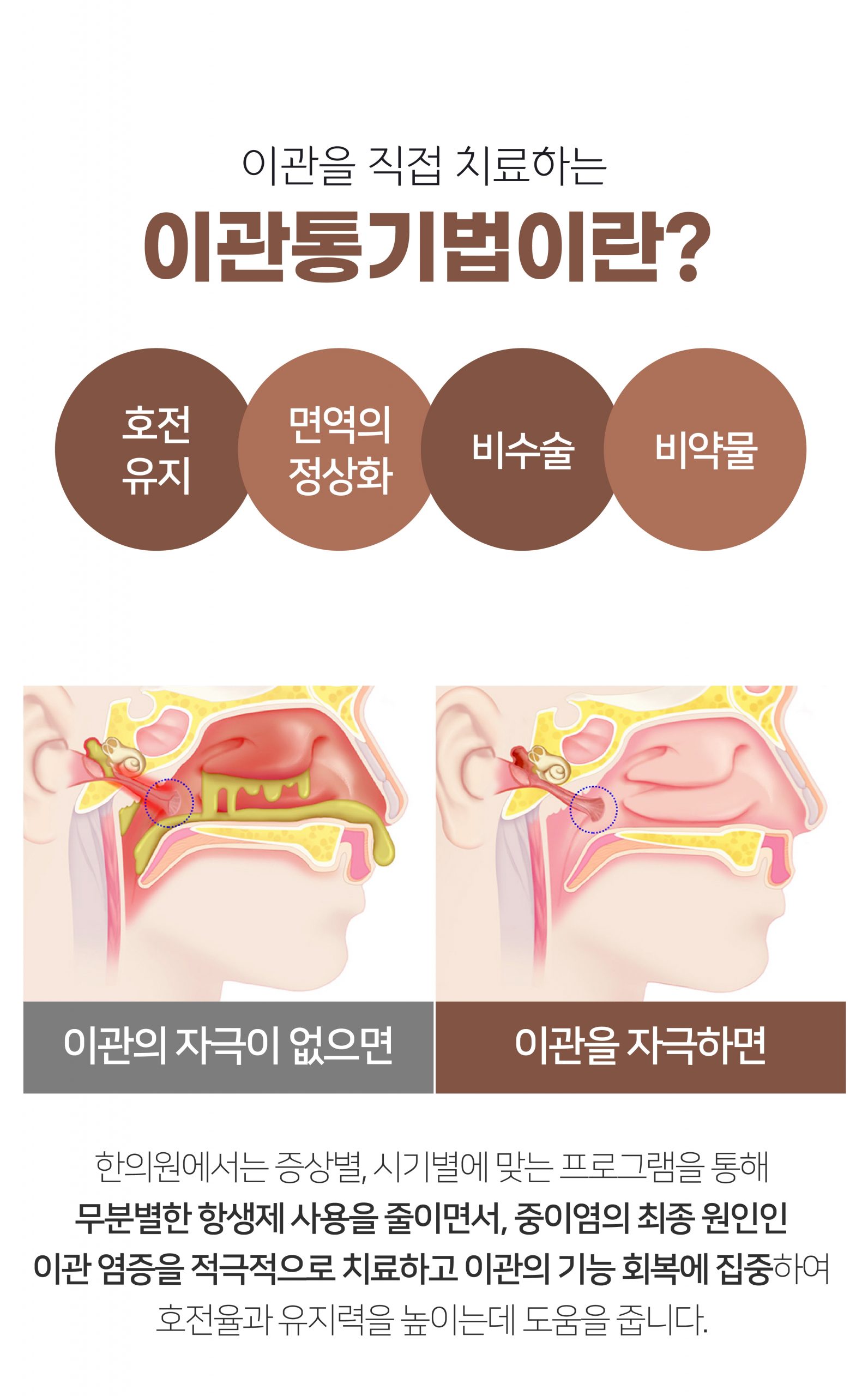 이천 중이염 치료005 scaled