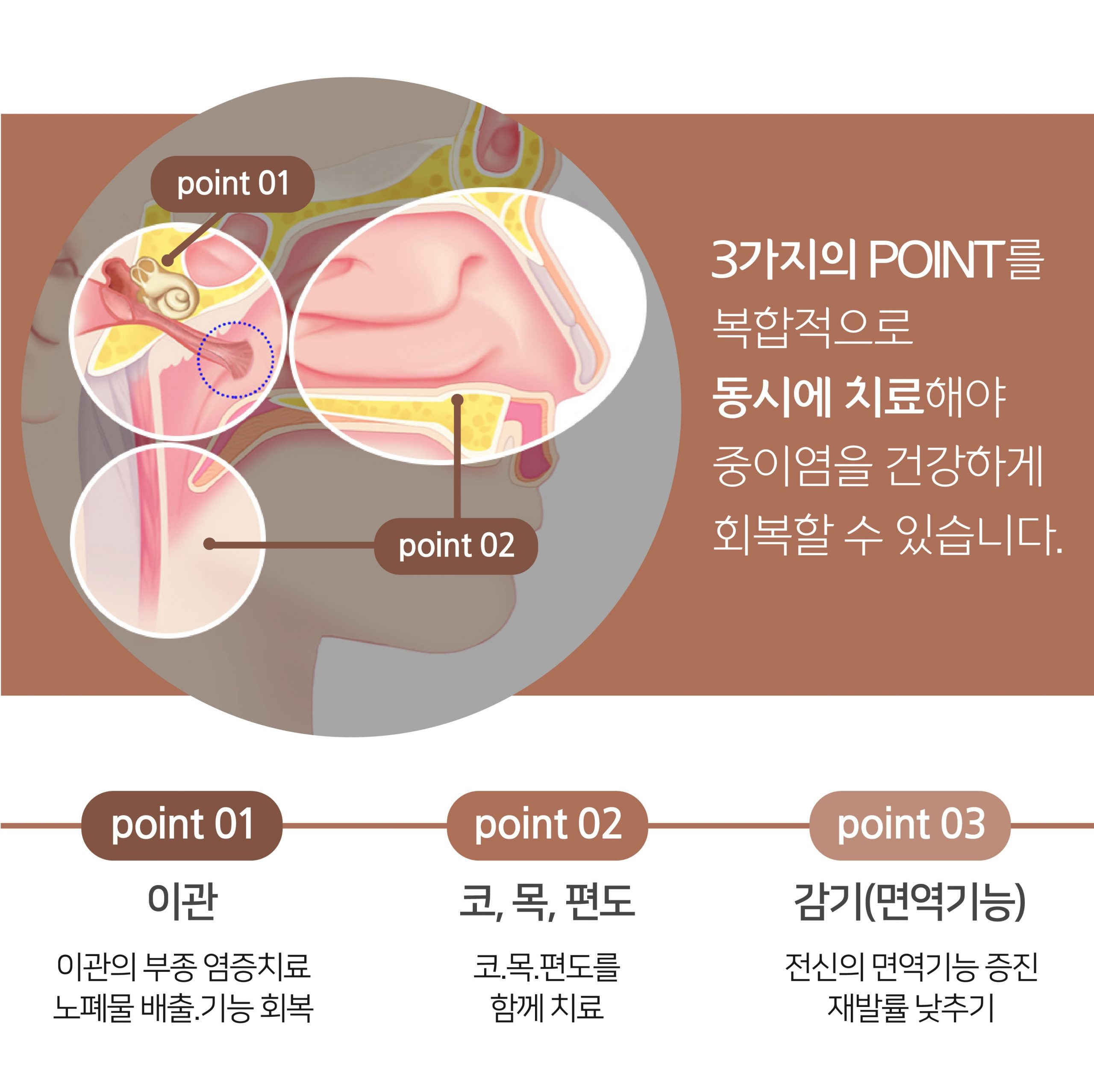 이천 중이염 치료006 scaled