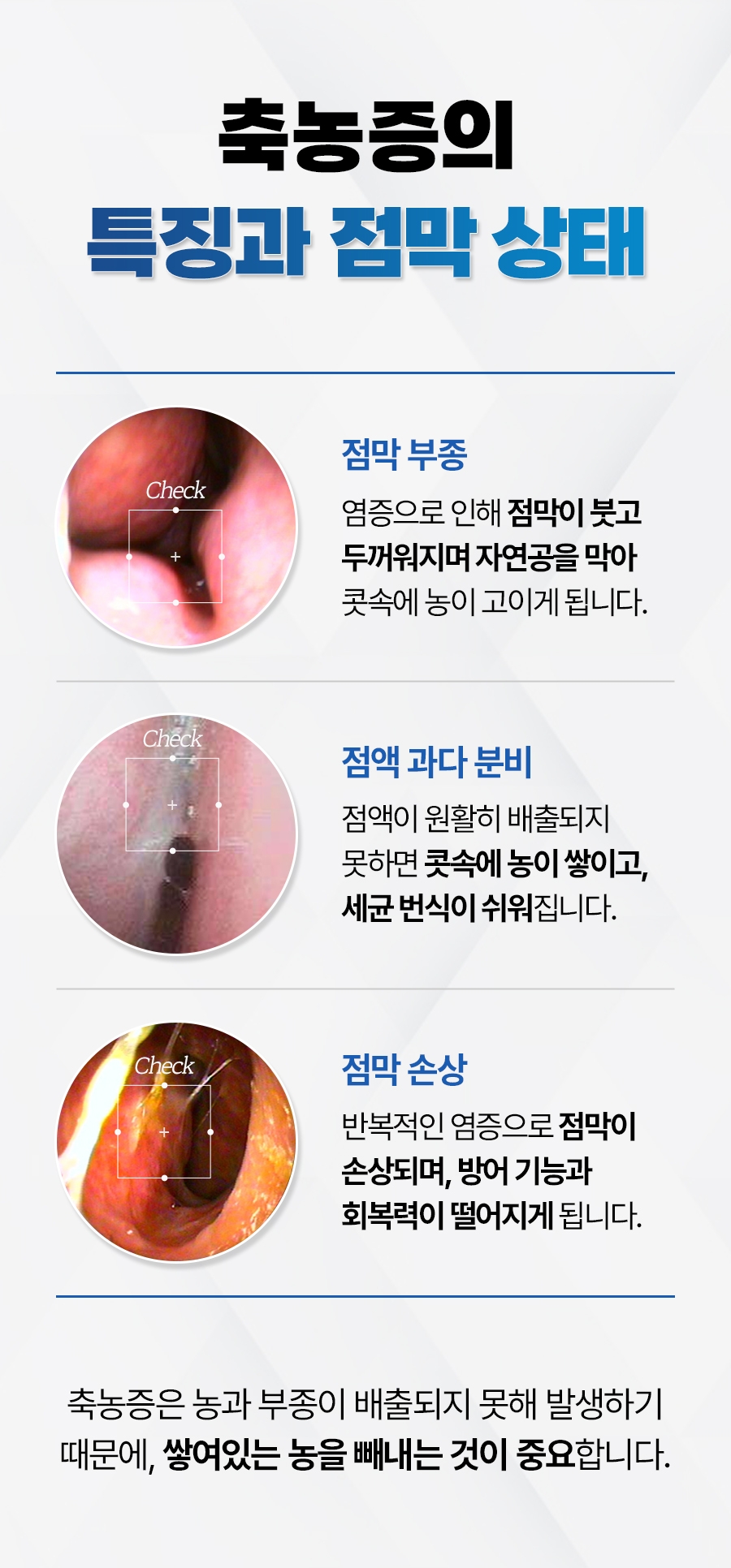 이천 축농증 치료05