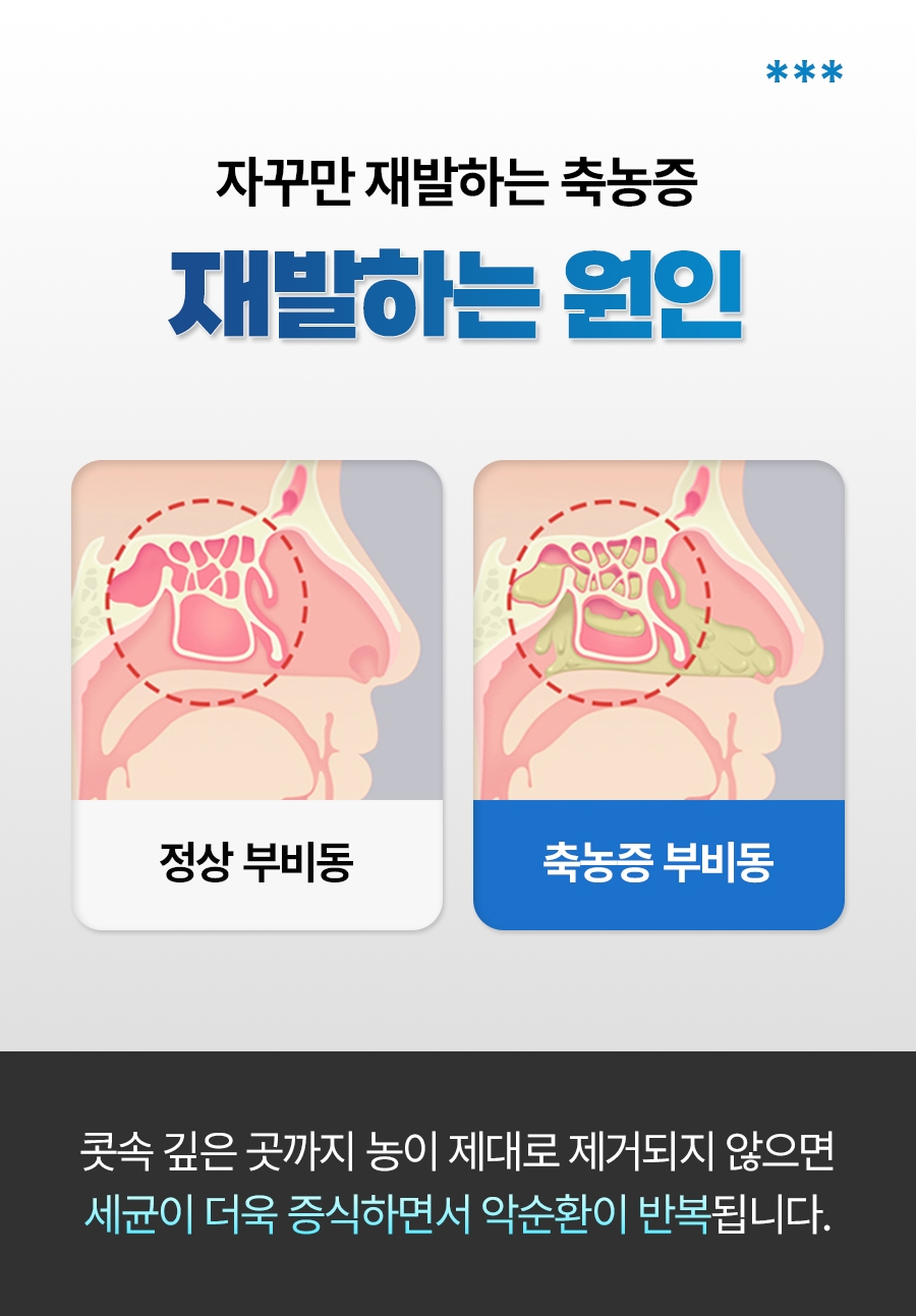 이천 축농증 치료06