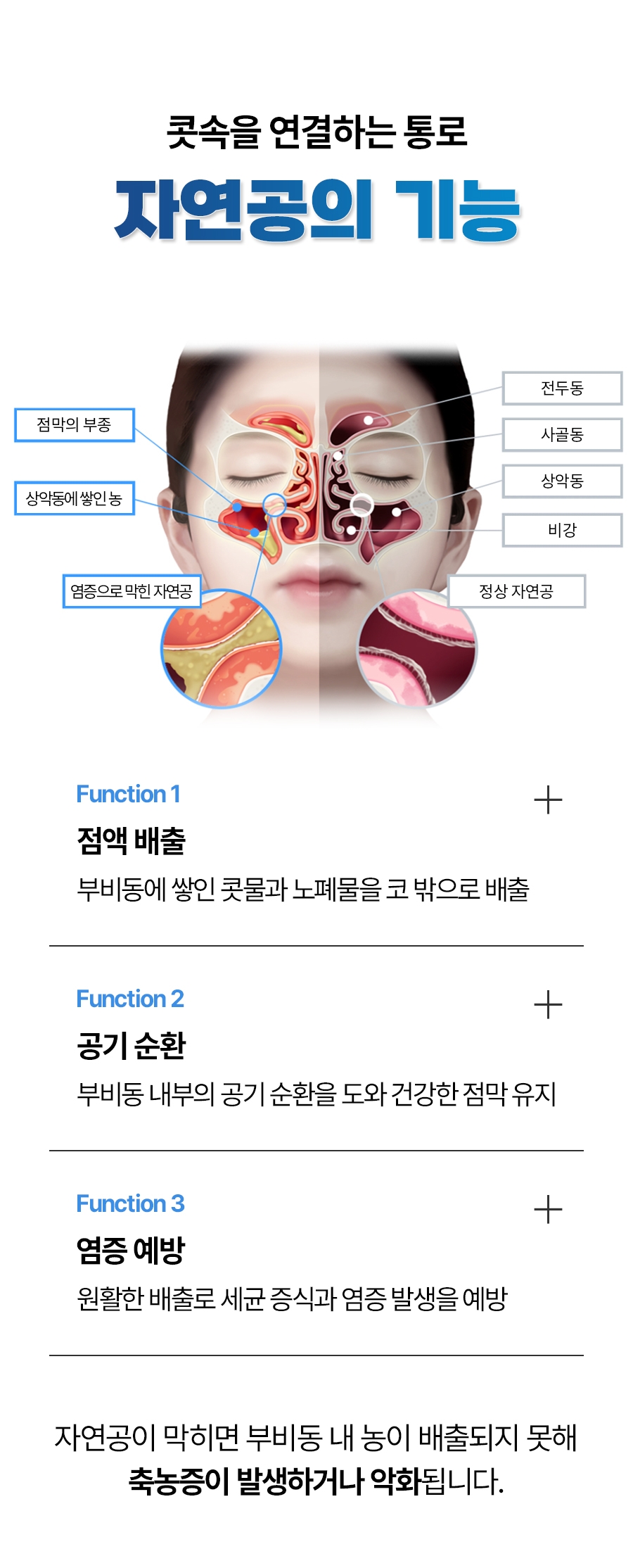 이천 축농증 치료07