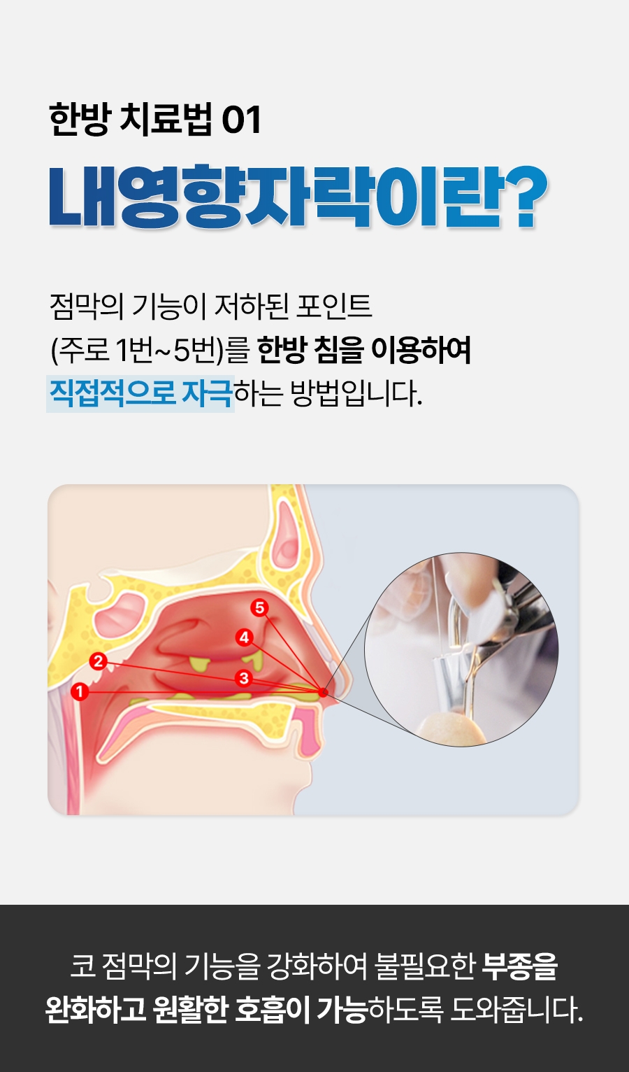 이천 축농증 치료08
