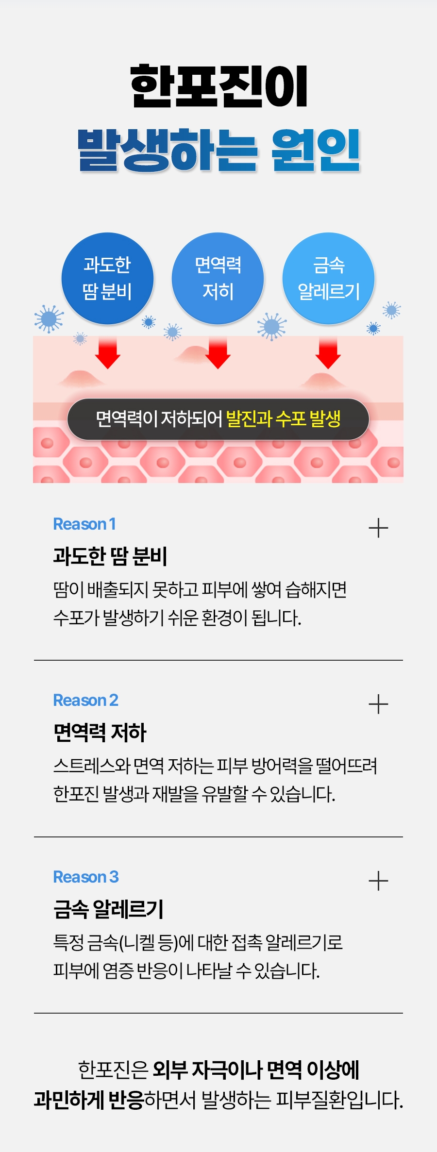 이천 한포진 치료03