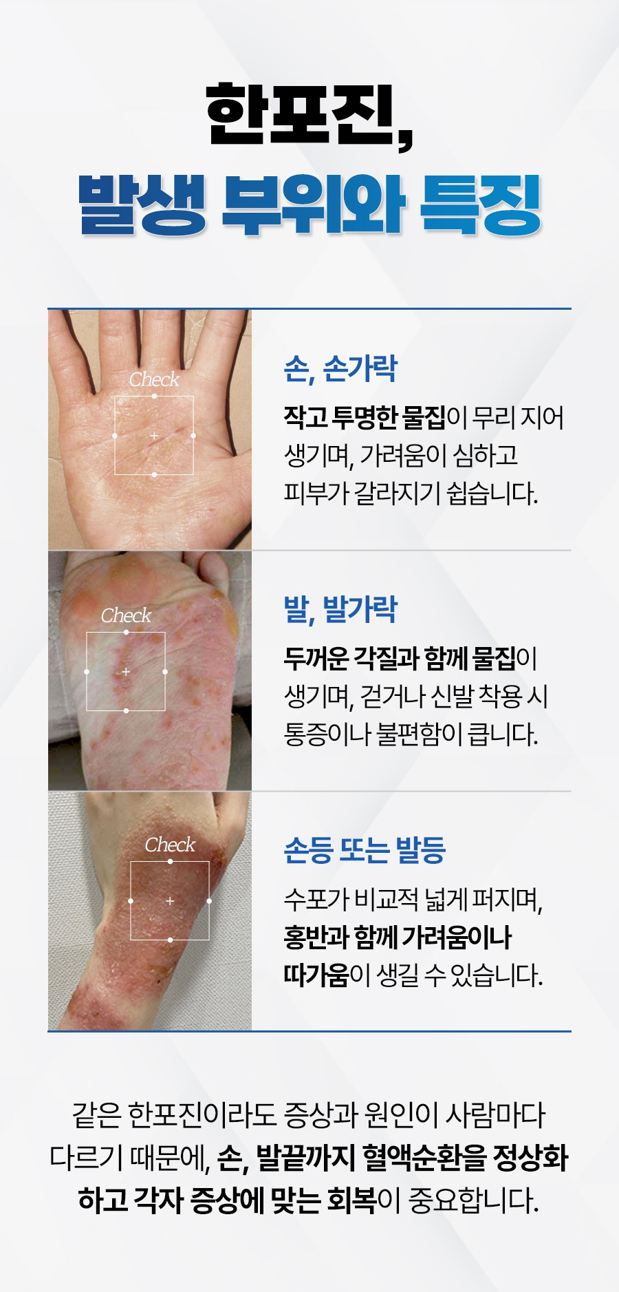 이천 한포진 치료06