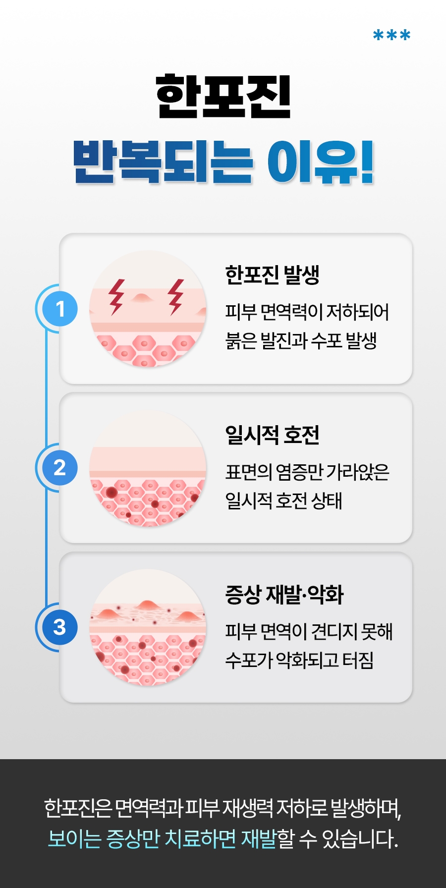 이천 한포진 치료07