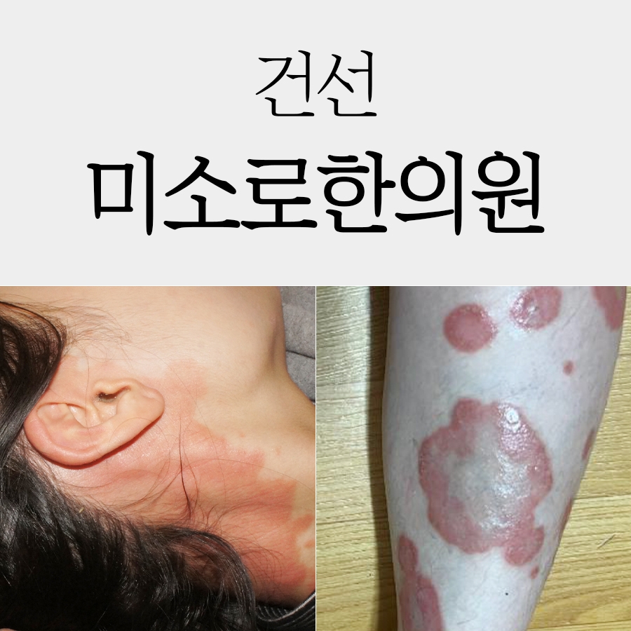 메디가이드 - 이천건선치료011