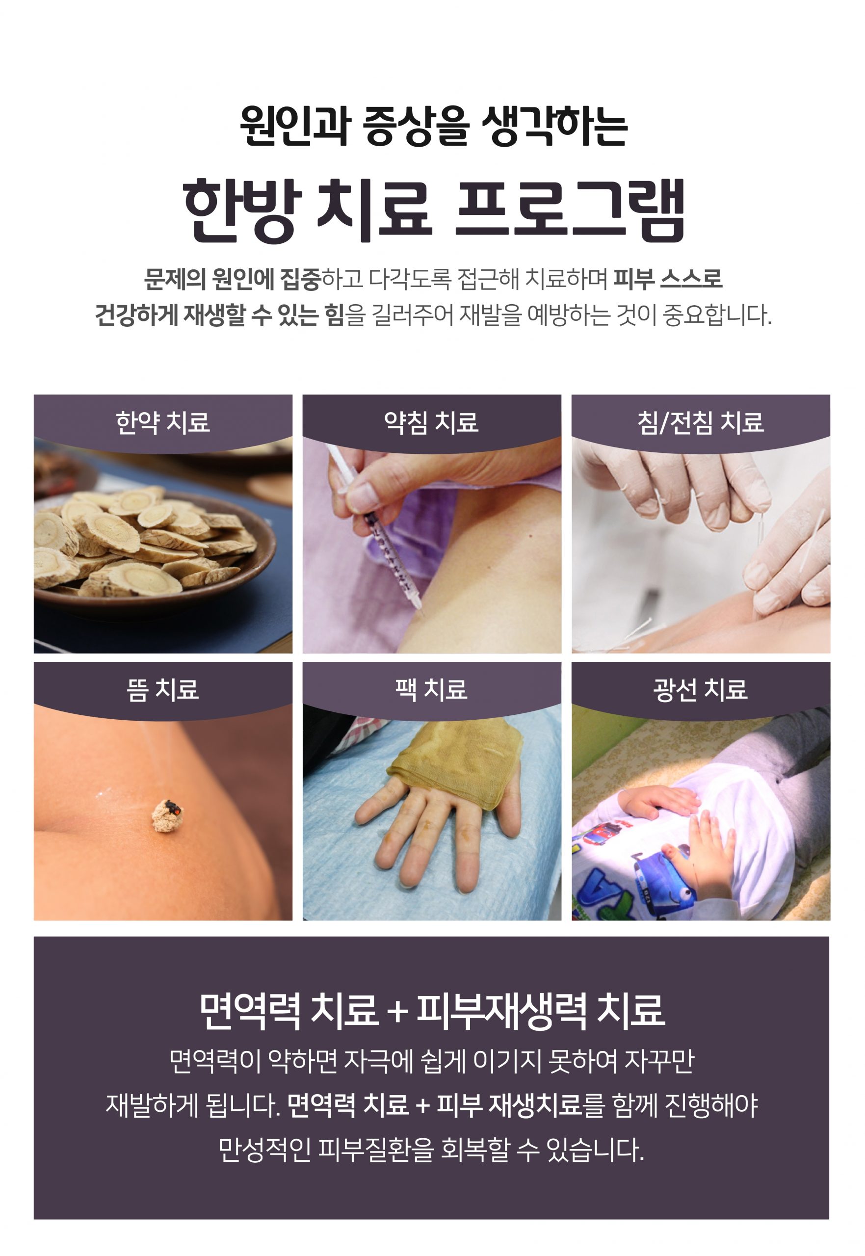 이천지루성피부염치료008 scaled