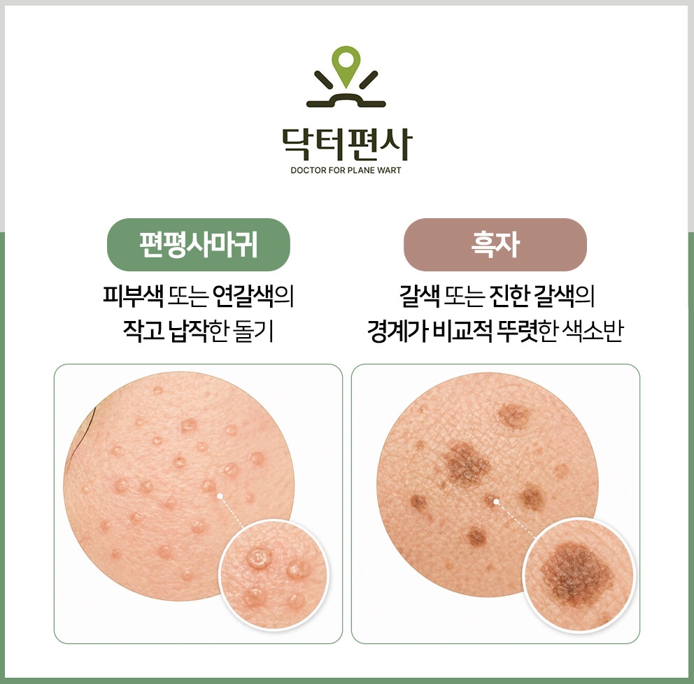이천편평사마귀성지10