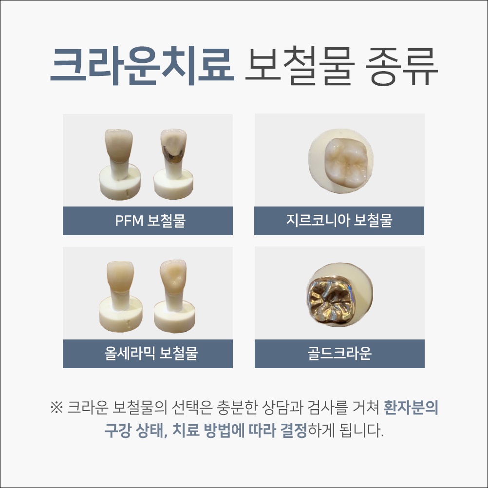 중앙동신경치료16