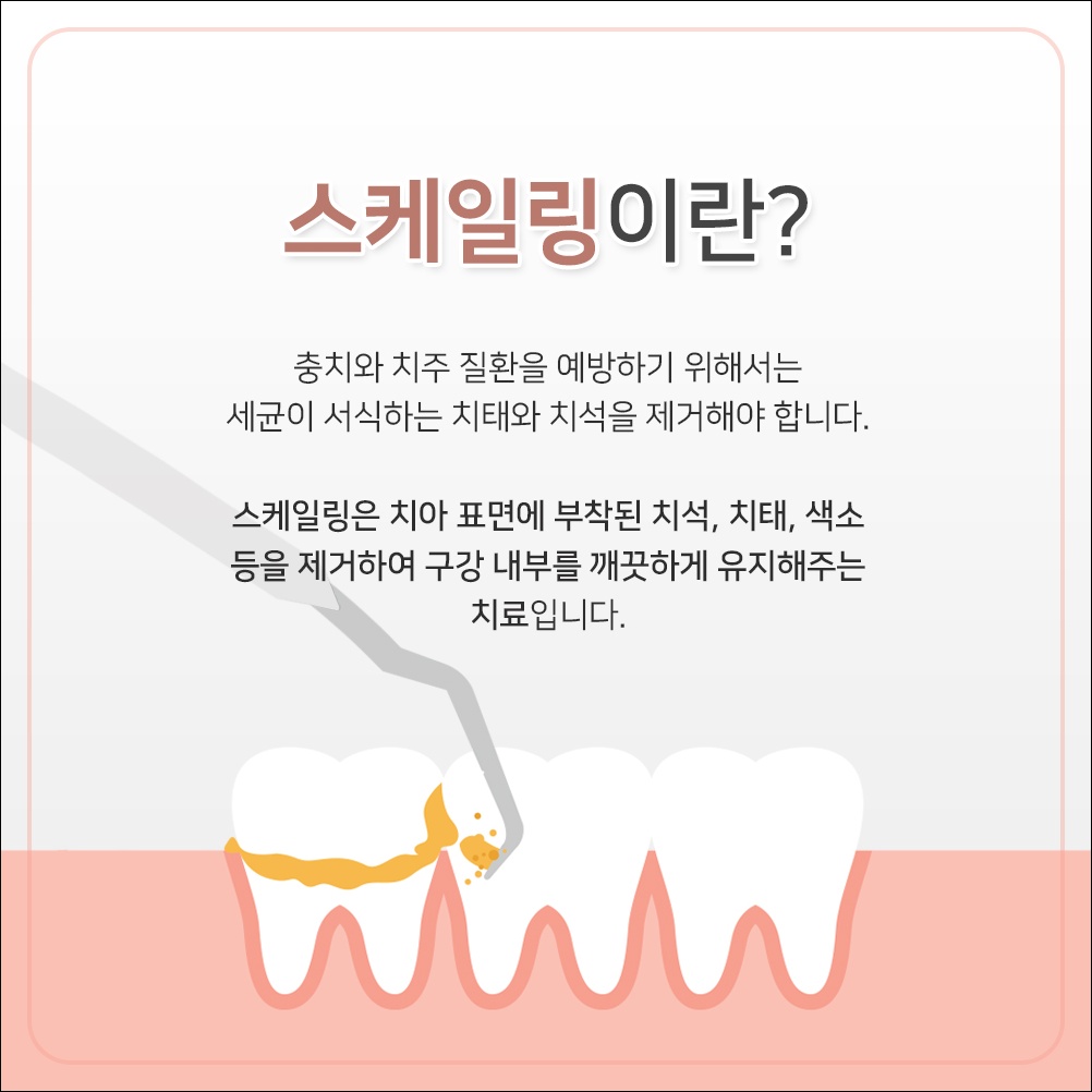 중앙동신경치료17