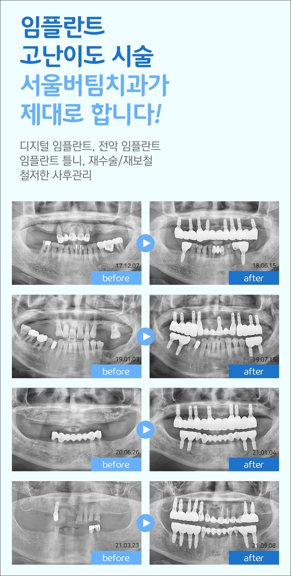 중앙동신경치료8