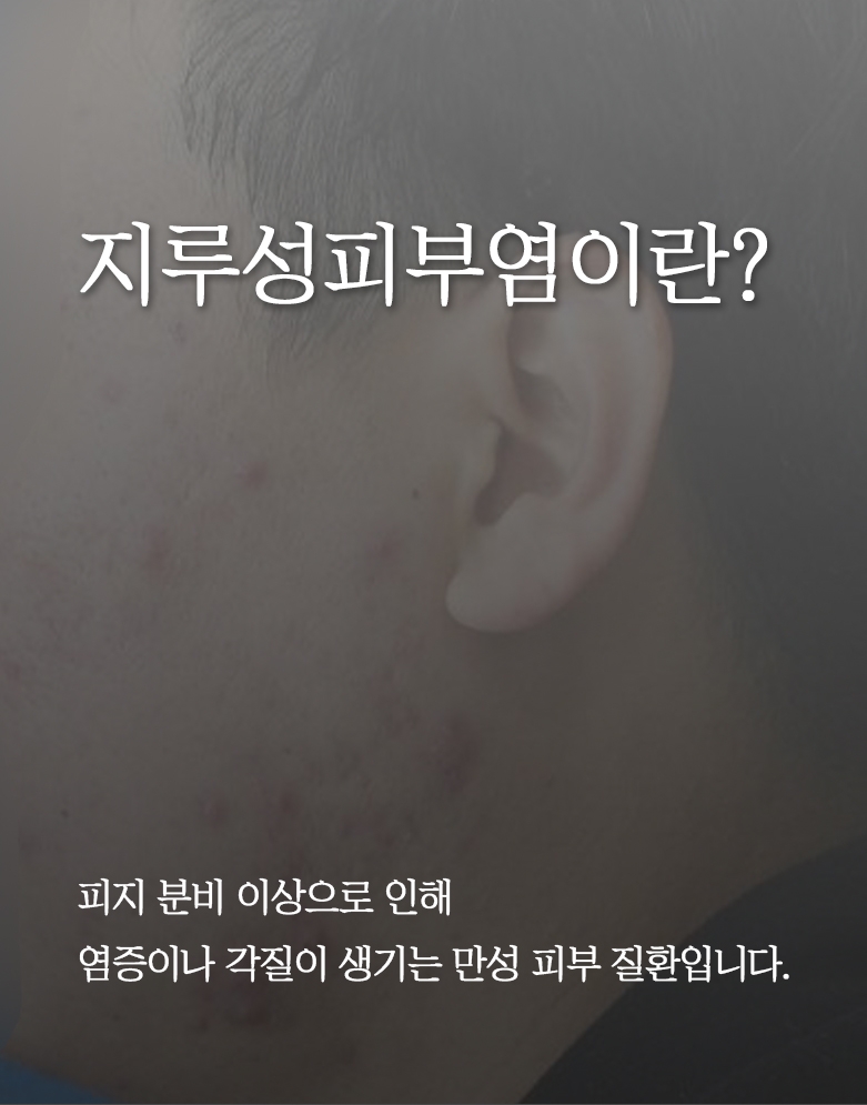 판교지루성피부염병원 008