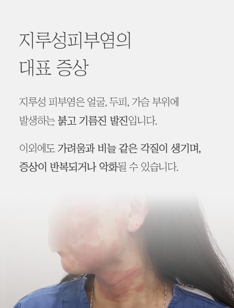 판교지루성피부염병원 011
