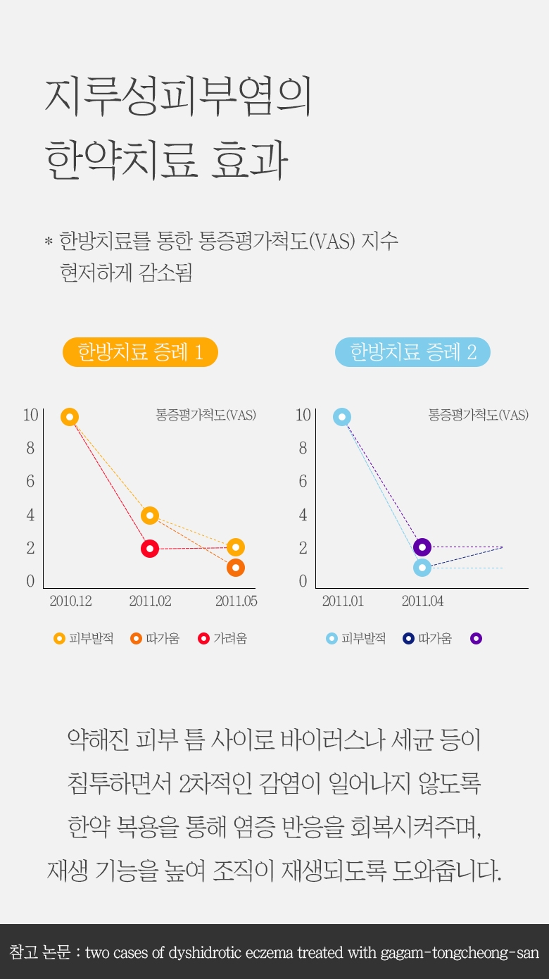 판교지루성피부염병원 016
