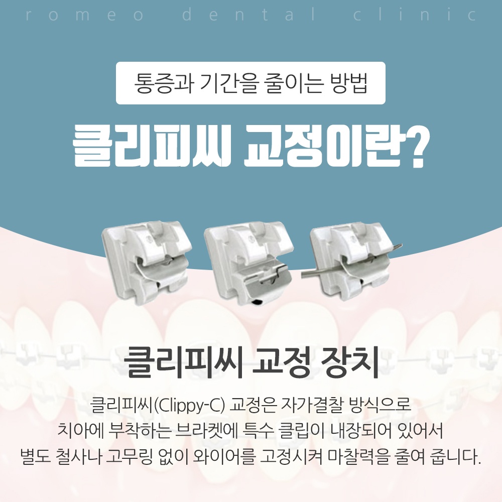 하d용인교정치과잘하는곳12