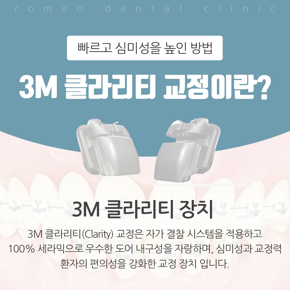 하d용인교정치과잘하는곳14